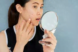 7. Stress Management: Unwind for Clear Skin