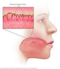 6. Dry Mouth and Bad Breath